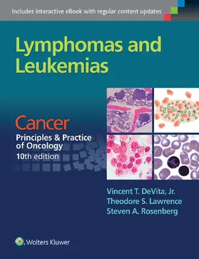 DeVita / Lawrence / Rosenberg |  Lymphomas and Leukemias | Buch |  Sack Fachmedien