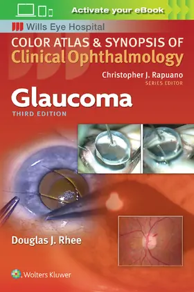 Rhee | Rhee, D: Glaucoma | Buch | 978-1-4963-6348-0 | sack.de