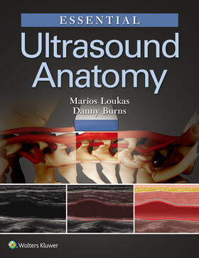 Loukas / Burns | Essential Ultrasound Anatomy | Buch | 978-1-4963-8353-2 | sack.de