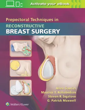 Gabriel / Nahabedian / Sigalove |  Prepectoral Techniques in Reconstructive Breast Surgery | Buch |  Sack Fachmedien