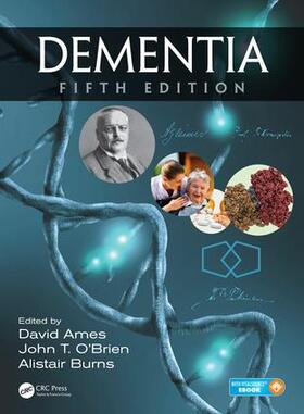 Ames / O'Brien / Burns | Dementia | Buch | 978-1-4987-0310-9 | sack.de