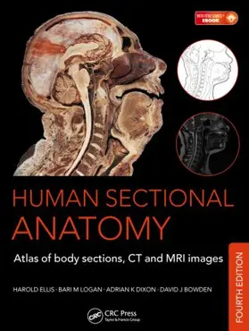 Logan / Ellis / Dixon |  Human Sectional Anatomy | Buch |  Sack Fachmedien