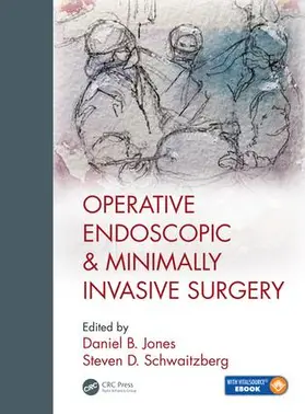 Jones / Schwaitzberg, M.D. |  Operative Endoscopic and Minimally Invasive Surgery | Buch |  Sack Fachmedien