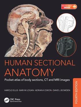 Dixon / Logan / Bowden | Human Sectional Anatomy | Buch | 978-1-4987-0854-8 | sack.de