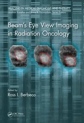 Berbeco |  Beam's Eye View Imaging in Radiation Oncology | Buch |  Sack Fachmedien