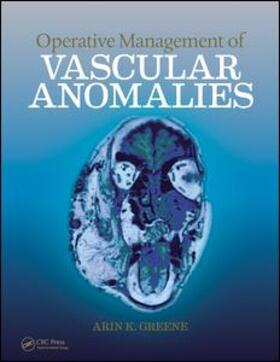 Greene | Operative Management of Vascular Anomalies | Medienkombination | 978-1-4987-4221-4 | sack.de