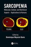 Meynial-Denis |  Sarcopenia | Buch |  Sack Fachmedien