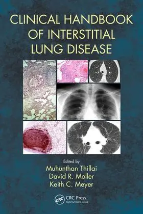 Thillai / Moller / Meyer |  Clinical Handbook of Interstitial Lung Disease | Buch |  Sack Fachmedien
