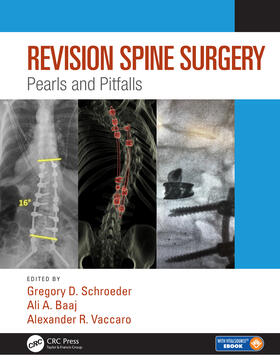 Schroeder / Baaj / Vaccaro | Revision Spine Surgery | Buch | 978-1-4987-7382-9 | sack.de