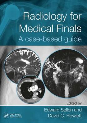 Howlett / Sellon | Radiology for Medical Finals | Buch | 978-1-4987-8216-6 | sack.de