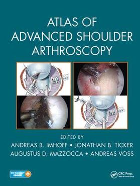 Imhoff / Ticker / Mazzocca | Atlas of Advanced Shoulder Arthroscopy | Buch | 978-1-4987-8748-2 | sack.de