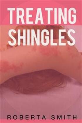 Smith |  Treating Shingles | eBook | Sack Fachmedien