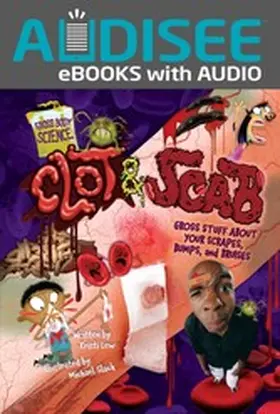 Lew |  Clot & Scab | eBook | Sack Fachmedien