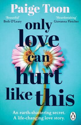 Toon |  Only Love Can Hurt Like This | Buch |  Sack Fachmedien