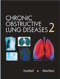 Voelkel / MacNee |  Chronic Obstructive Lung Diseases | Buch |  Sack Fachmedien