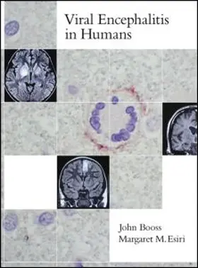 Booss / Esiri |  Viral Encephalitis in Humans | Buch |  Sack Fachmedien