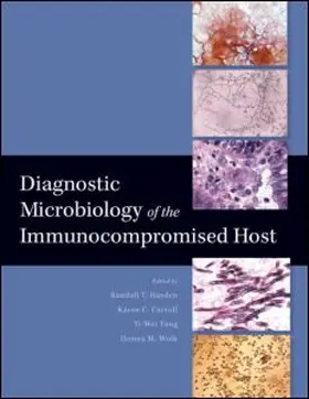 Hayden / Carroll / Tang | Diagnostic Microbiology of the Immunocopromised Host | Buch | 978-1-55581-397-0 | sack.de