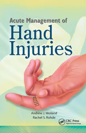 Weiland / Rohde |  Acute Management of Hand Injuries | Buch |  Sack Fachmedien