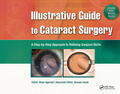 Agarwal |  Illustrative Guide to Cataract Surgery | Buch |  Sack Fachmedien