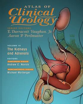 Vaughan / Perlmutter / Novick | Atlas of Clinical Urology | Buch | 978-1-57340-122-7 | sack.de