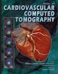 Narula / Budoff / Achenbach |  Atlas of Cardiovascular Computed Tomography | Buch |  Sack Fachmedien