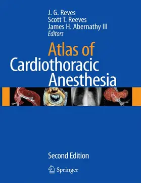 Reves / Reeves / Abernathy, III |  Atlas of Cardiothoracic Anesthesia | Buch |  Sack Fachmedien
