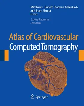 Budoff / Achenbach / Narula |  Atlas of Cardiovascular Computed Tomography | Sonstiges |  Sack Fachmedien