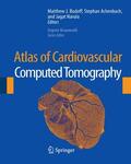 Budoff / Achenbach / Narula |  Atlas of Cardiovascular Computed Tomography | Sonstiges |  Sack Fachmedien