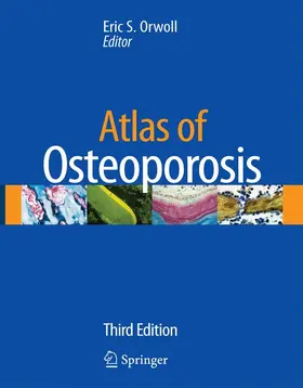Orwoll |  Atlas of Osteoporosis | Buch |  Sack Fachmedien