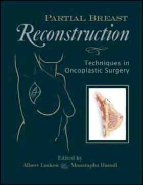 Losken / Hamdi | Partial Breast Reconstruction | Medienkombination | 978-1-57626-283-2 | sack.de