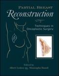 Losken / Hamdi |  Partial Breast Reconstruction | Buch |  Sack Fachmedien