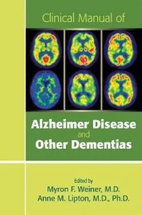 Weiner / Lipton |  Clinical Manual of Alzheimer Disease and Other Dementias | eBook | Sack Fachmedien