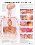  Understanding Diabetes Anatomical Chart | Sonstiges |  Sack Fachmedien