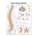  Human Spine Disorders Anatomical Chart | Sonstiges |  Sack Fachmedien