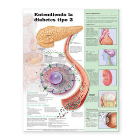  Understanding Type 2 Diabetes Anatomical Chart in Spanish (Comprendiendo la diabetes tipo 2) | Sonstiges |  Sack Fachmedien