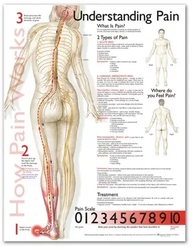  Understanding Pain Anatomical Chart | Sonstiges |  Sack Fachmedien