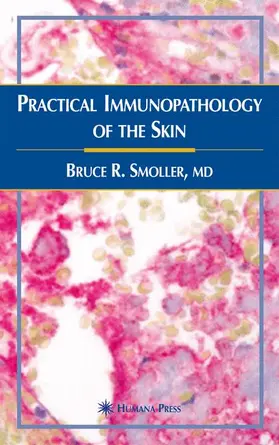 Smoller |  Practical Immunopathology of the Skin | Buch |  Sack Fachmedien