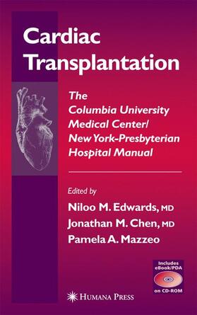 Edwards / Chen / Mazzeo |  Cardiac Transplantation | Buch |  Sack Fachmedien