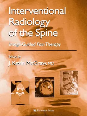 McGraw | Interventional Radiology of the Spine | Buch | 978-1-58829-198-1 | www.sack.de