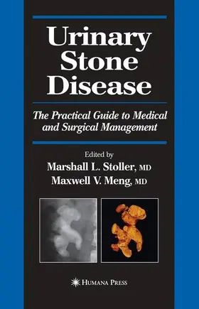 Stoller / Meng |  Urinary Stone Disease | Buch |  Sack Fachmedien
