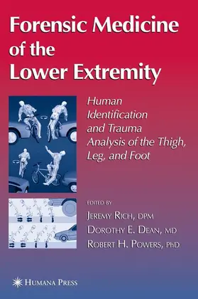 Rich / Powers / Dean |  Forensic Medicine of the Lower Extremity | Buch |  Sack Fachmedien