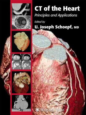 Schoepf | CT of the Heart | Buch | 978-1-58829-303-9 | sack.de