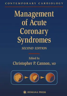Cannon |  Management of Acute Coronary Syndromes | Buch |  Sack Fachmedien