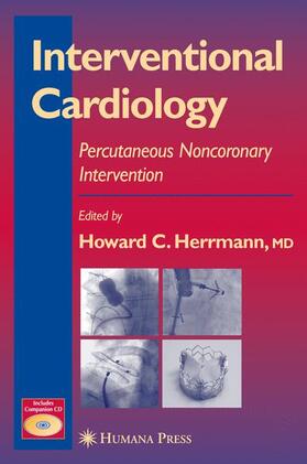 Herrmann |  Interventional Cardiology | Buch |  Sack Fachmedien