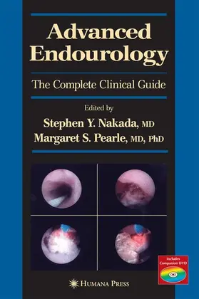 Pearle / Nakada | Advanced Endourology | Buch | 978-1-58829-446-3 | sack.de