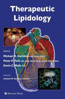 Davidson / Maki / Toth |  Therapeutic Lipidology | Buch |  Sack Fachmedien