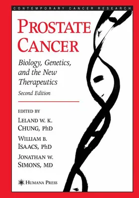 Chung / Isaacs / Simons |  Prostate Cancer | Buch |  Sack Fachmedien