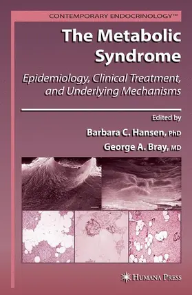 Hansen / Bray |  The Metabolic Syndrome: | Buch |  Sack Fachmedien