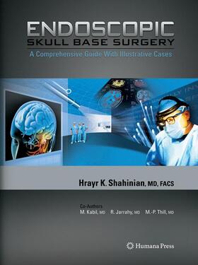 Shahinian |  Endoscopic Skull Base Surgery | Buch |  Sack Fachmedien
