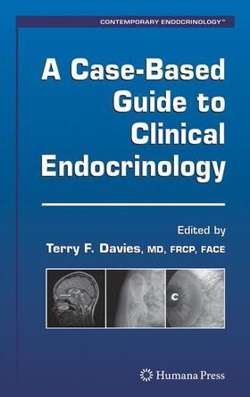 Davies | A Case-Based Guide to Clinical Endocrinology | Buch | 978-1-58829-815-7 | sack.de